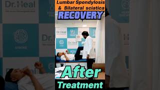 Lumbar Spondylosis amp Bilateral Sciatica Recovery After Treatment yt ad viralvideo reachout [upl. by Adnor]