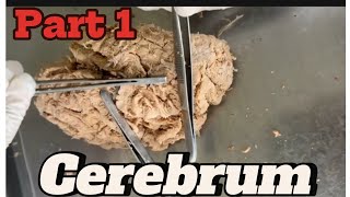 Gyri and sulci of cerebrum part 1 mbbsanatomy nepalforyou viral medicalhacks [upl. by Llehcar]