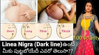 How to Know the Gender Of Baby with Linea NigraBody changes during pregnancyBaby Boy Symptoms [upl. by Euqinim]