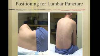 Lumbar Puncture [upl. by Bucella460]