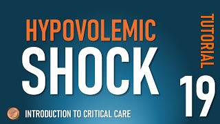 Hypovolemic Shock [upl. by Drawyah201]