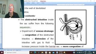 Hernia in Arabic 6  Strangulated hernia  part 1  by Dr Wahdan [upl. by Adnirolc119]