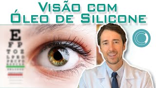 Como é a visão com óleo de silicone dentro do olho [upl. by Leander436]