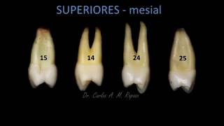 Anatomia PréMolares [upl. by Chesney189]