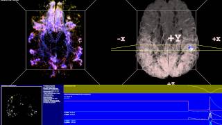 Thalamocortical Loops  Spiking Neural Network Simulation [upl. by Lal302]