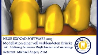 EXOCAD TUTORIALS 2015  Modellation einer vollverblendeten Brücke by Michael Anger [upl. by Cooe]