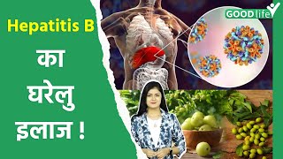 Hepatitis B Ka Gharelu Ilaj Symptoms Treatment In Hindi Goodlife [upl. by Kendricks]