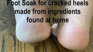 Crazy Simple Foot Soak to Heal Cracked Heels Ingredients you can find around the house [upl. by Raveaux203]