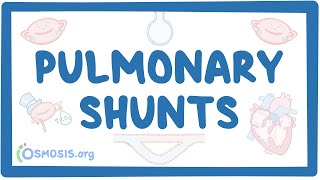 Pulmonary shunts [upl. by Anwaf]