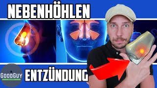 Nebenhöhlenentzündung was hilft wirklichAnatomieUrsachen 4 wichtige Vitalstoffe die du brauchst [upl. by Afas101]