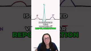 Unveiling the Hidden Signals of ECG Atrial Repolarization Inside the QRS Complex [upl. by Notnerb]