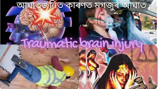 আঘাতজনিত কাৰণত মগজুৰ আঘাত Unveiling Traumatic Brain Injury  Shocking truth atout Brain Injury 🧠 [upl. by Gibun]