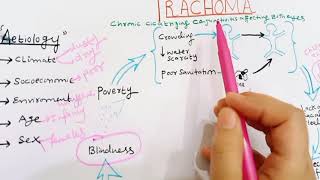 Trachoma  Pathogenesis Of Trachoma  conjunctivitis  ophthalmology  PART 01 [upl. by Nevarc313]