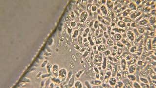 Yeast cells [upl. by Essirahc4]