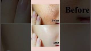 How to minimise open pores on face 💕skinbeautytips beatytips shortvideo shorts [upl. by Roye533]