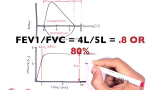 Understanding Spirometry  Normal Obstructive vs Restrictive [upl. by Lerud]