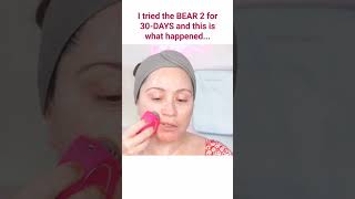 FOREO BEAR 2⚡30DAY CHALLENGE RESULTS 😮foreo bear2 30daychallenge [upl. by Aivalf]