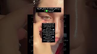 علاج أكثر شيء نعاني منه✨ الهالات السوداء تحت العينين 💕 [upl. by Crenshaw]