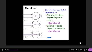 Anisometropia and antimetropia  pupil size and blur circlesemmetrope part 5 [upl. by Ibrab]