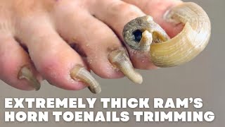 We Trim Toe Nails on quotThe Revquot Is Trimming Toenails Feel Good [upl. by Charil958]