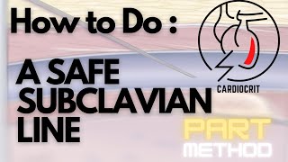 How to do a SAFE SUBCLAVIAN LINE  The PART Method [upl. by Ahsinnod]