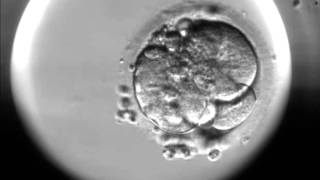 Timelapse of fertilisation of a human egg under the microscope [upl. by Trebliw]