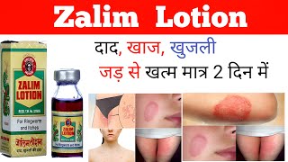 Zalim Lotion की सम्पूर्ण जानकारी  दाद खाज खुजली का पक्का इलाज़  उपयोग करना चाहिए या नहीं 💊💉💊🩺😷🥼 [upl. by Eivad]