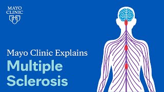 Mayo Clinic Explains Multiple Sclerosis [upl. by Hepsoj507]