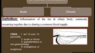 uveal tract pt 2 [upl. by Elletnahs]