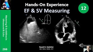 HandsOn Experience 12 EF amp SV Measuring [upl. by Fabrianne969]