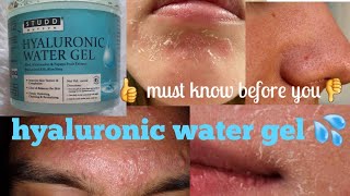 Hyaluronic water gel 💦 25 दिन use करने के बाद genuine reviewsStud muffin [upl. by Ahmar]