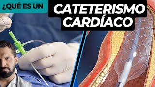 Que es un cateterismo cardiaco [upl. by Lucita]