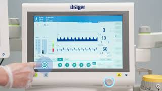 Lowflow anaesthesia for lung protective ventilation with Atlan anaesthesia workstations [upl. by Ozne]