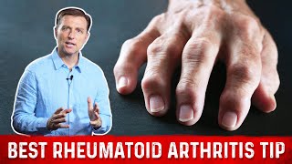 Best Tip For Rheumatoid Arthritis – Joint Pain Relief By DrBerg [upl. by Eilyac527]