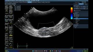 5565 CRYPTORCHIDISM  ECHOPAC ANALYSIS HIDDEN TESTIS ABDOMINAL ULTRASOUND DOG [upl. by Kcirdahs585]