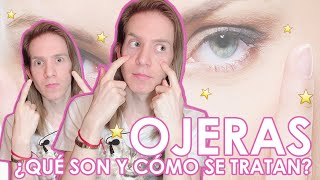 ¿CÓMO SE TRATAN LAS OJERAS Aprende a diagnosticar y tratar tu tipo de ojeras [upl. by Laine]