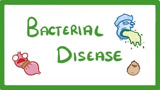 GCSE Biology  What Are Bacterial Diseases  Treatment and Prevention 37 [upl. by Aldas]