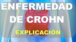 Qué es la Enfermedad de CROHN [upl. by Gratia]