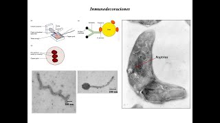 Uso de la Microscopia electrónica en el estudio de parásitos [upl. by Nassah]