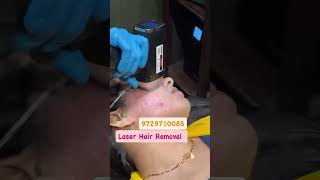 LASER HAIR REMOVAL hairremoval shorts drshahidmirza youtubeshorts hair [upl. by Anod]