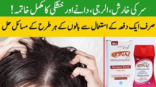 3 quick ways to stop hair fall and hair loss at home  anti hair fall shampoo  dandruff pewdiepie [upl. by Airdua]