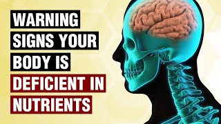 10 Warning Signs Your Body Is Deficient in Nutrients [upl. by Eenrahc798]