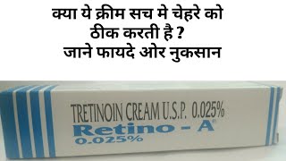 Retinoa Cream 0025 Review In Hindi । Tretinoin Cream [upl. by Tonia]