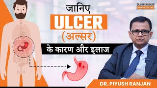 जानिए Ulcer अल्सर क्यों होता है और इलाज क्या है  Duodenal and Gastric Ulcers Treatment [upl. by Bobbi]