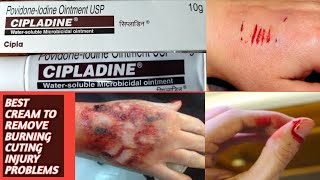 BEST OINTMENT TO TREAT FORBURNINGCUTINGINJURY PAINSCIPLADINE OINTMENT FULL REVIEW IN TELUGU USES [upl. by Dhiman]