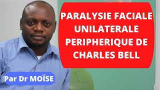 Paralysie faciale périphérique unilatérale à frigoré de Charles Bell [upl. by Raskin]