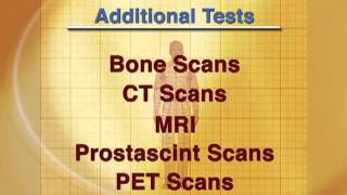 Prostate Cancer Treatment 06 Stage of the Disease [upl. by Naerda]