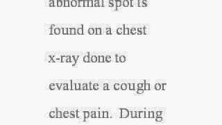 Diagnosis of Lung Cancer  Lung Cancer Diagnosis [upl. by Nnasor]