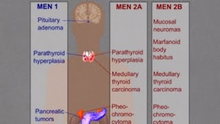 MEN 1 Wermer Syndrome [upl. by Schreibe]