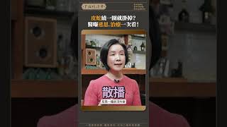 皮蛇繞一圈就掛掉醫曝迷思治療一次看 [upl. by Krantz]